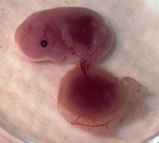 original placenta