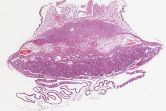 placenta slide