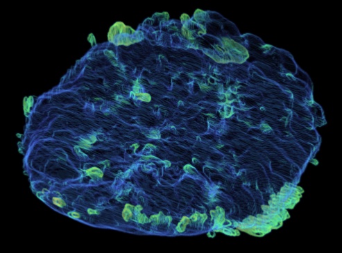 rendered placenta