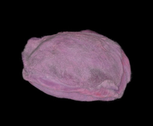 rendered placenta