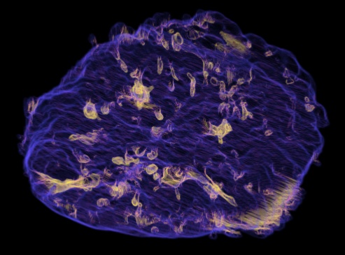 rendered placenta