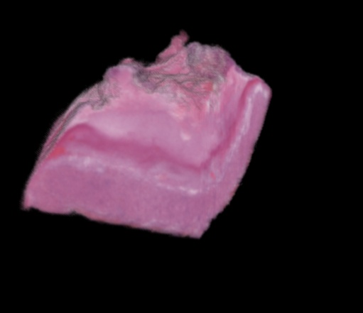 rendered placenta