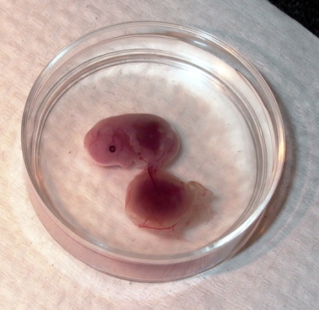 placenta