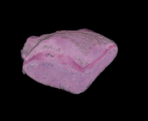 rendered placenta
