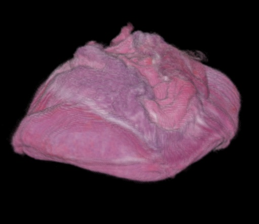 rendered placenta